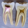 medical-model, dentists-model,